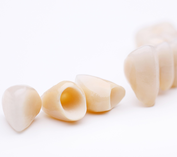 Tyler Dental Crowns and Dental Bridges