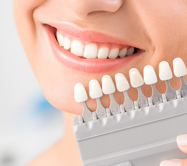 Tyler Dental Veneers and Dental Laminates