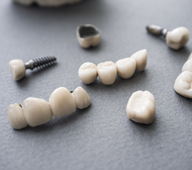 Tyler The Difference Between Dental Implants and Mini Dental Implants